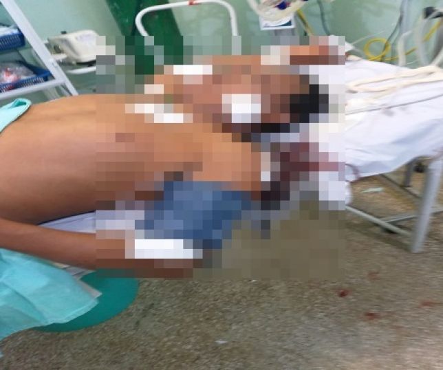 Notícias IMAGENS FORTES Homem é baleado seis tiros por dois